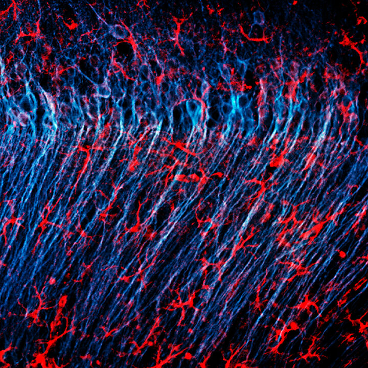 Mikroskopische Aufnahme eines Gehirns, in der Astrozyten und Nervenzellen farbig hervorgehoben sind.